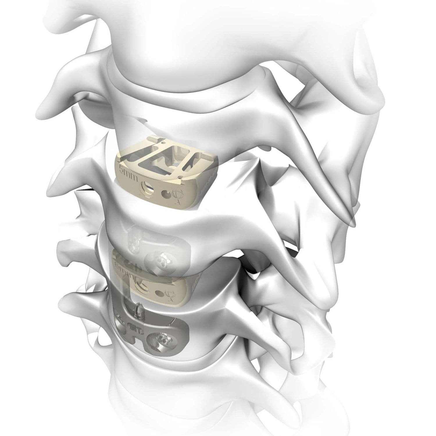 HWSZwischenwirbelimplantat Rebar Atlas Spine ventraler Zugang / aus PEEK