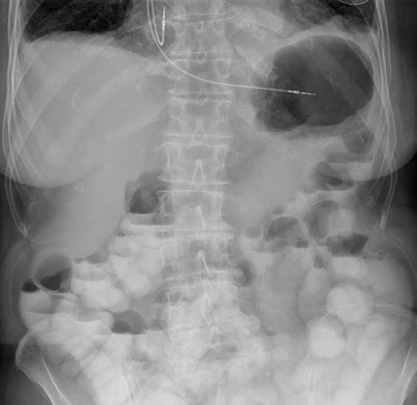 Medizinische Software UNIQUE 2 Philips Healthcare Anatomie / für