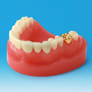Anatomisches Modell / Gebiss - PE-PRO001 - Nissin Dental Products Inc. -  Zahnfleisch / fr Zahnprothesen / fr die Ausbildung