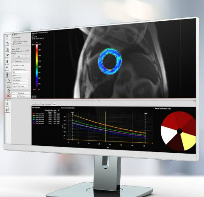 Medizinische Software Pie Medical Imaging für Kliniken / MRT