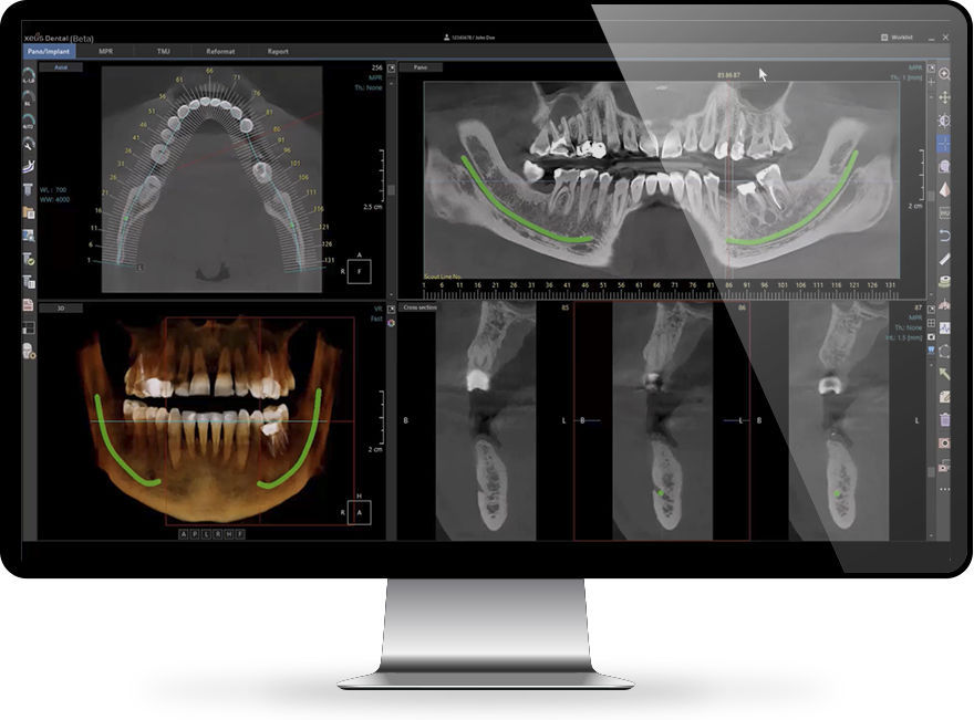 Medizinische Software Xelis™ INFINITT North America Dental