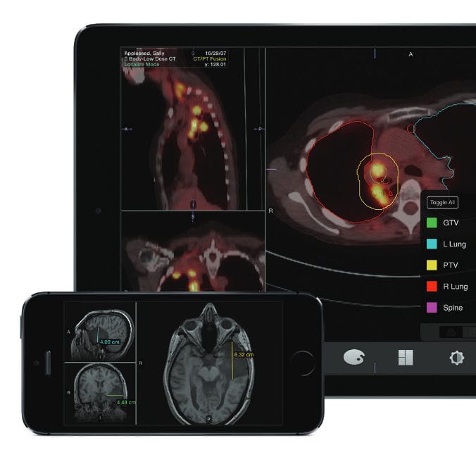 IOS-Anwendung / Für Medizinische Bildgebung - Mobile Mim - MIM Software