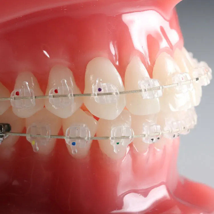 Orthodontie Bracket / ästhetisch - Vapor™ - G&H Orthodontics - Keramik /  transparent