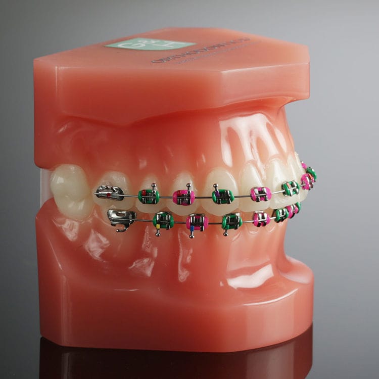 Kieferorthopädisches Gummi / Ligatur BambinoTies™, VersaTies