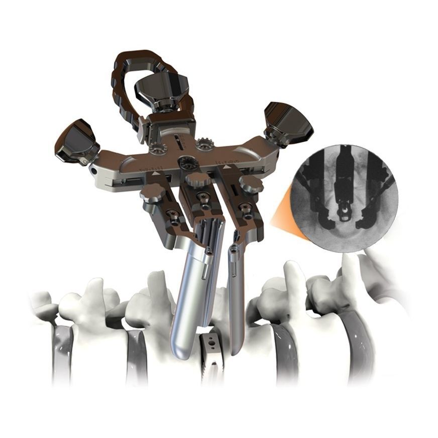 Retraktor für orthopädische Chirurgie - CENTRIC® - Life Spine - Anatomie