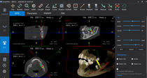 Software für dentale Bildgebung / für Dentalimplantologie...