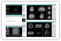 TDM-Software / für Kliniken / Analyse /...