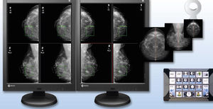 Software-Modul / für Mammographie