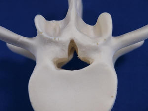 Bandscheibe Anatomisches Modell / Lendenwirbel / für Ausbildung / Pathologie