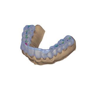 Software-Modul / für Dentalimplantologie