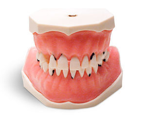Anatomisches Modell / Zahn 1