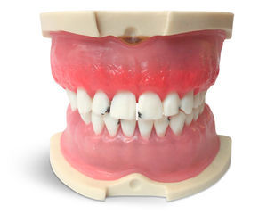 Anatomisches Modell / Zahn 1