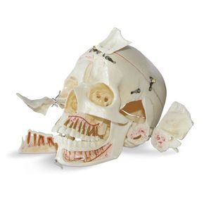 anatomisches Schädelmodell