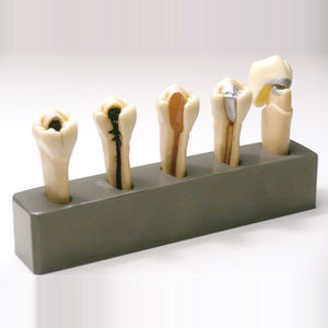 Anatomisches Modell / Zahn 1