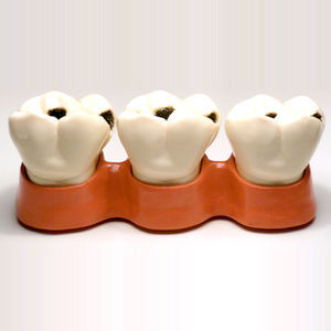 Anatomisches Modell / Zahn 1