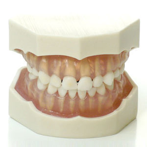 Anatomisches Modell / Zahn 1