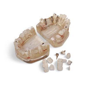 Anatomisches Modell / Zahn 1