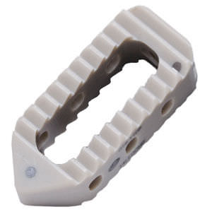thorako-lumbales Zwischenwirbelimplantat 1