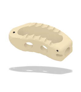 LWS-Zwischenwirbelimplantat