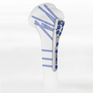 Knochen-Kompressionsplatte / Humerus / proximal