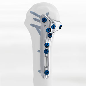 Knochen-Kompressionsplatte / Humerus / proximal