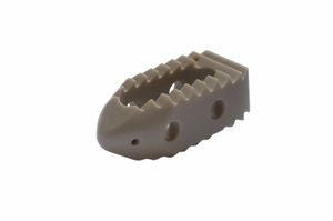 LWS-Zwischenwirbelimplantat