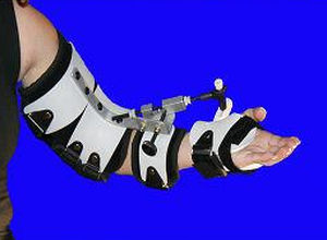 Unterarmschiene