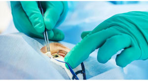 Medizinisches Set / für Augenchirurgie