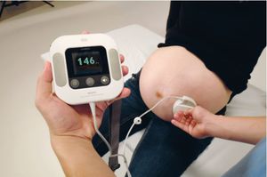 FHR-Fetalmonitor