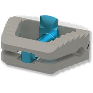 HWS-Zwischenwirbelimplantat 1