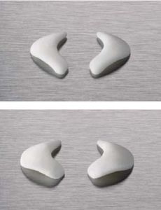 Implantat, ästhetisch / Nasen