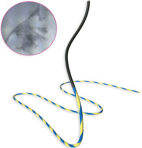 Führungsdraht für Sonde