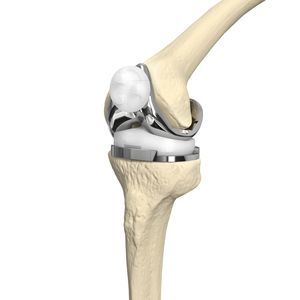 Femur-Patella Knieprothese