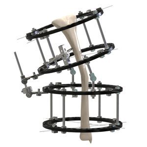 Fixateur externe / für Tibia 1
