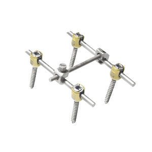 Stabilisierungssystem für Osteosynthese / HWS