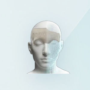Gesicht Implantat, ästhetisch 1