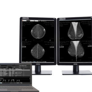 Software für Mammographie