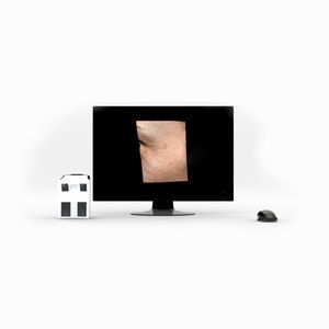 Hautanalysesystem / 3D-Bildgebung des Gesichts