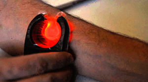 LED-Venensucher