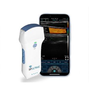 konvexe Ultraschallsonde 1