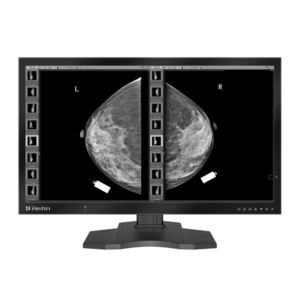 Diagnose-Monitor