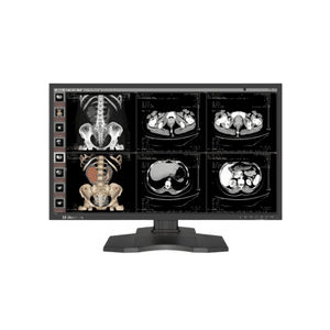 Monitor für medizinische Bildgebung