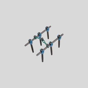 thorako-lumbales Stabilisierungssystem für Osteosynthese 1