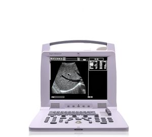 tragbares Tierärztliches Ultraschallsystem 1