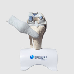Implantat, ästhetisch / Knie 1
