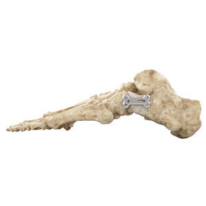 Osteotomieplatte für Hallux Valgus 1