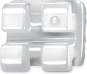 Orthodontie Bracket / ästhetisch 1