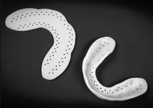 Aligner 1