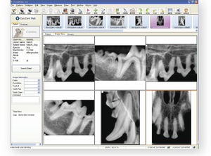 Software für veterinär dentale Bildgebung