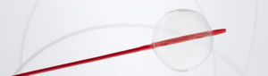 Stent-Platzierung-Katheter / Aorta / Ballon